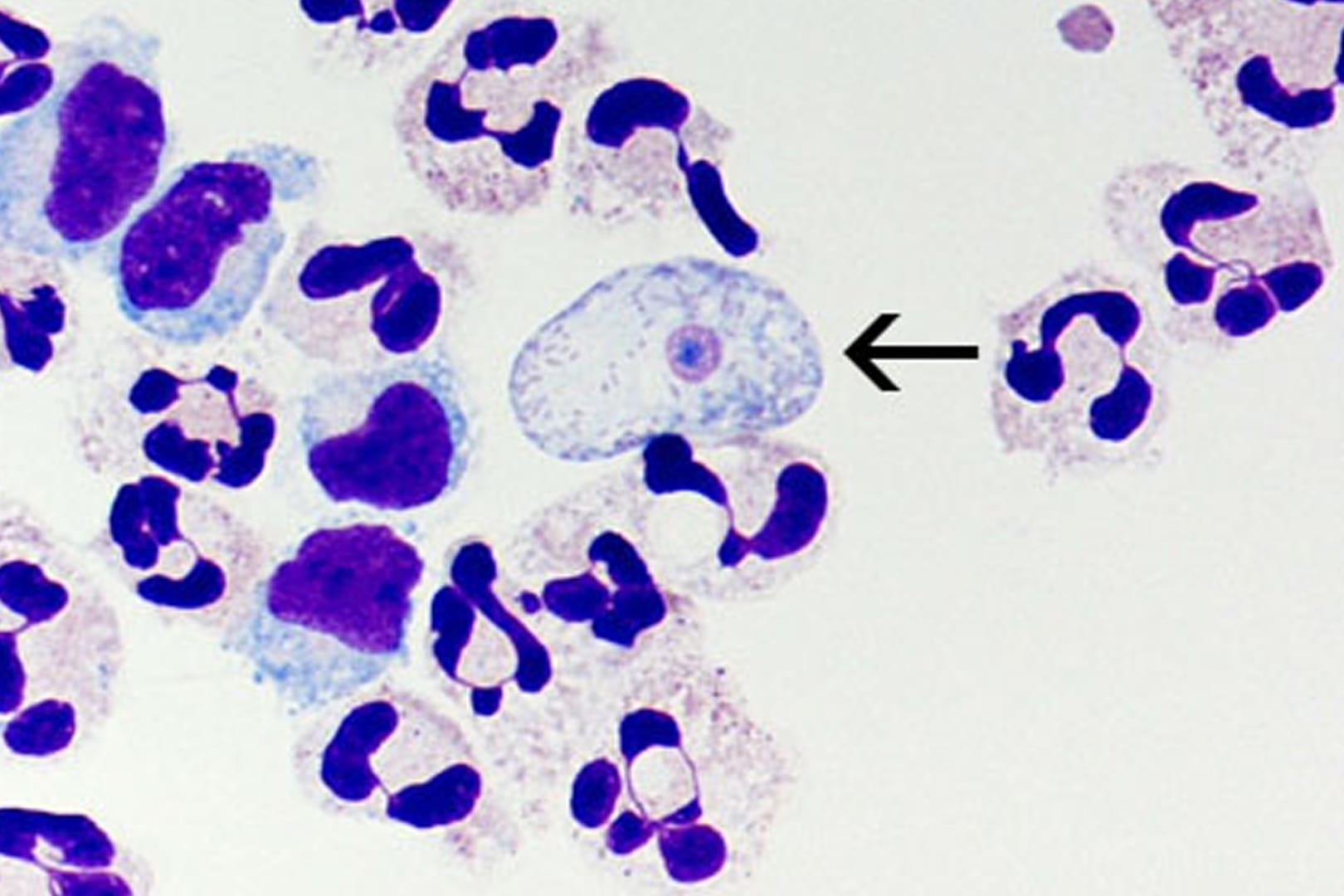 "Naegleria fowleri" unter dem Mikroskop: Die Amöben dringen ins Gehirn ein.