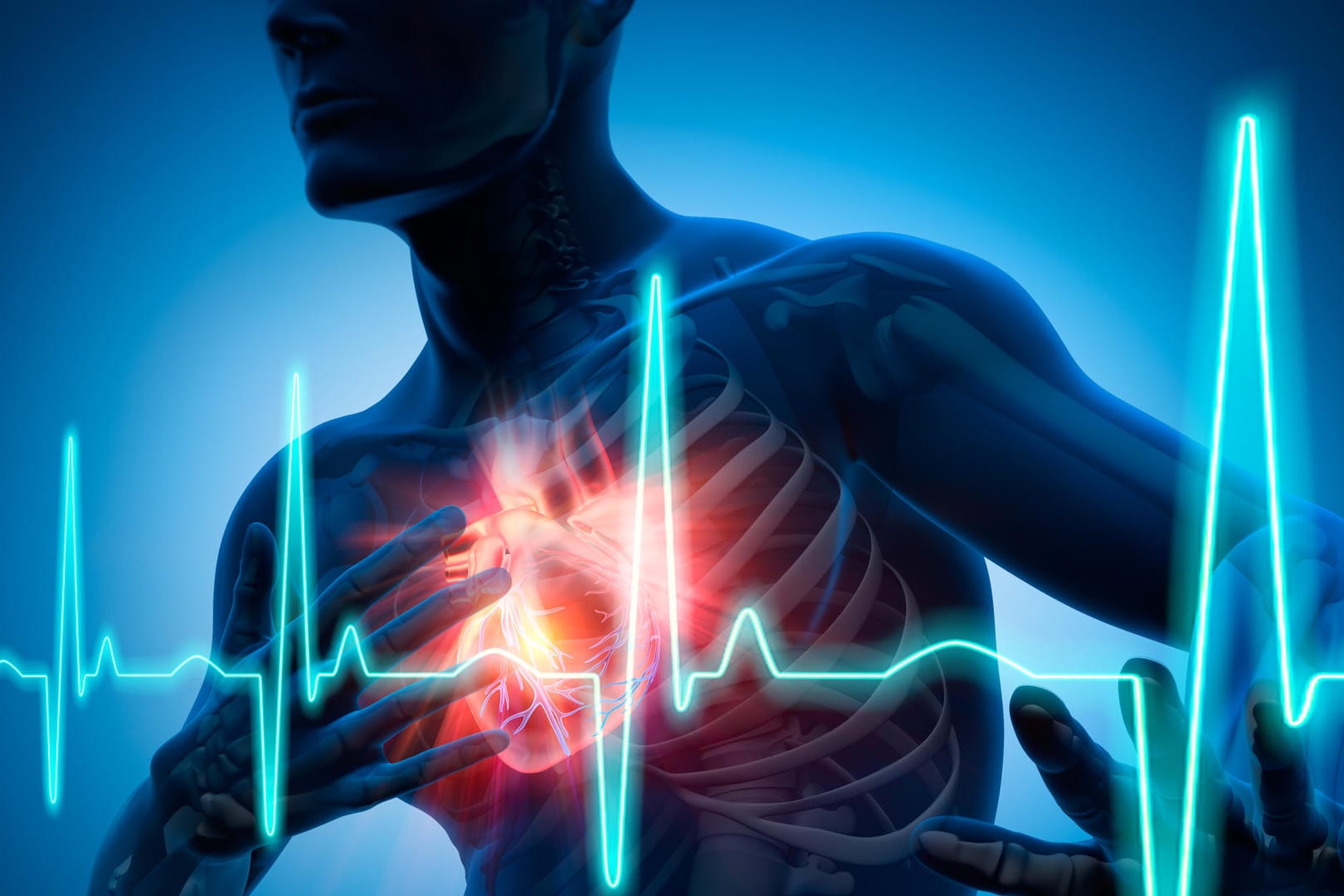 Eine instabile Angina Pectoris kann der Vorbote eines Herzinfarkts sein.