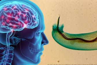 Grafik vom menschlichen Gehirn und einem Wurm: Der auf Mallorca entdeckte Ratten-Lungenwurm kann Hirnhautentzündungen auslösen.