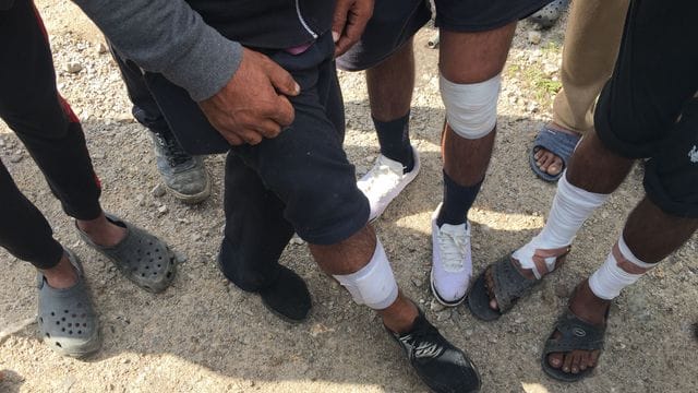 Migranten aus Pakistan zeigen Verletzungen an den Beinen.