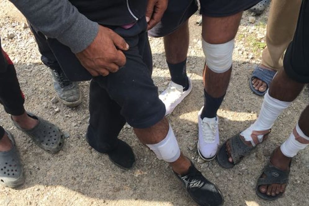 Migranten aus Pakistan zeigen Verletzungen an den Beinen.