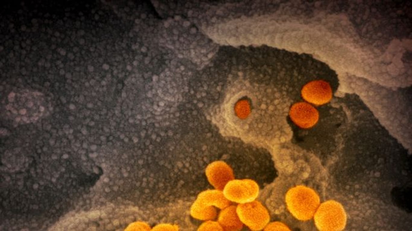 Eine elektronenmikroskopische Aufnahme zeigt das neuartige Coronavirus, das aus der Oberfläche von im Labor kultivierten Zellen austritt.