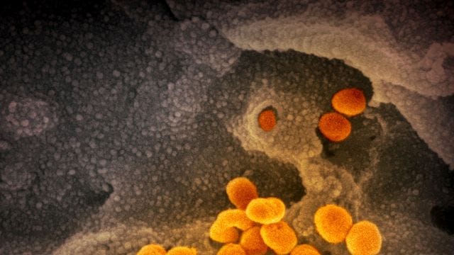 Eine elektronenmikroskopische Aufnahme zeigt das neuartige Coronavirus, das aus der Oberfläche von im Labor kultivierten Zellen austritt.