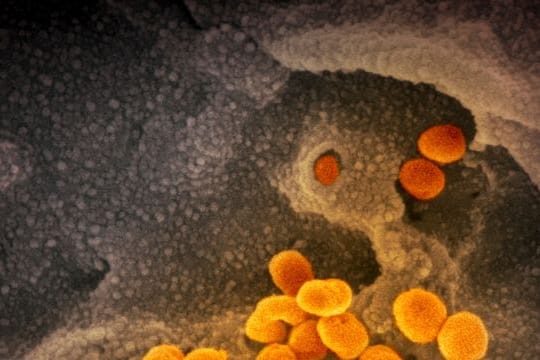 Eine elektronenmikroskopische Aufnahme zeigt das neuartige Coronavirus, das aus der Oberfläche von im Labor kultivierten Zellen austritt.