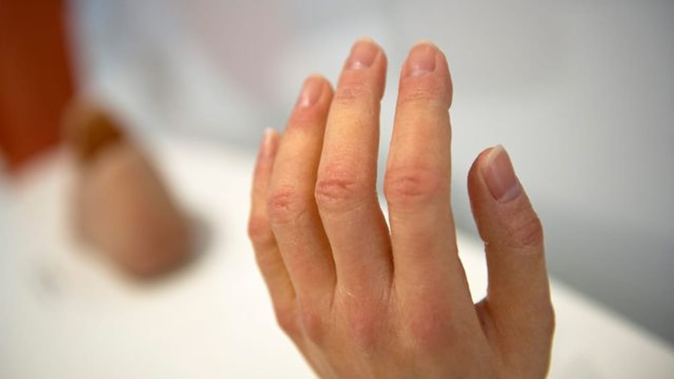 Aus Silikon hergestellte Prothesen für Finger und Hand können täuschend echt aussehen.