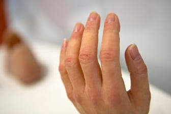 Aus Silikon hergestellte Prothesen für Finger und Hand können täuschend echt aussehen.