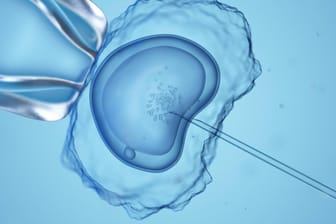 Eine künstliche Befruchtung unter einem Mikroskop (Symbolbild): In einer Klinik in den USA kam es zu einer Verwechslung. Jetzt klagen die Eltern.