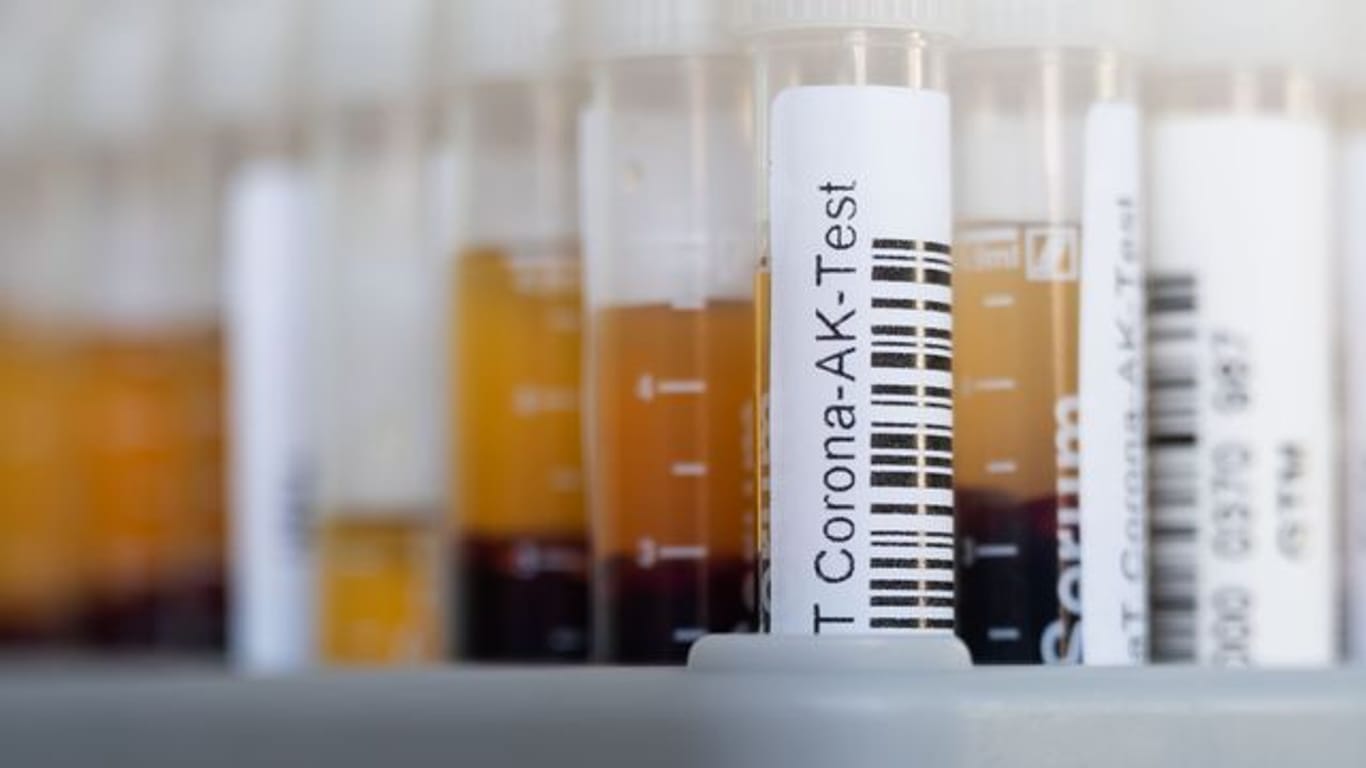 November 2021: Für einen Antikörpertest wird Blut abgenommen und analysiert.