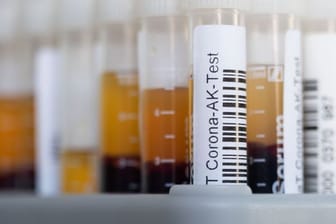 November 2021: Für einen Antikörpertest wird Blut abgenommen und analysiert.