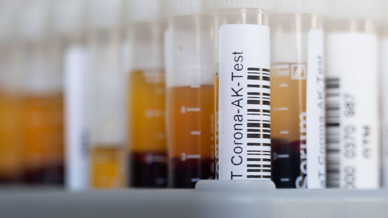 November 2021: Für einen Antikörpertest wird Blut abgenommen und analysiert. November 2021: Für einen Antikörpertest wird Blut abgenommen und analysiert.