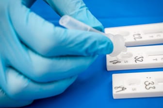 Ein Laborhelfer befüllt Corona-Testplatten mit Proben (Archivbild): Die Infektionszahlen in Deutschland sind weiterhin auf hohem Niveau.