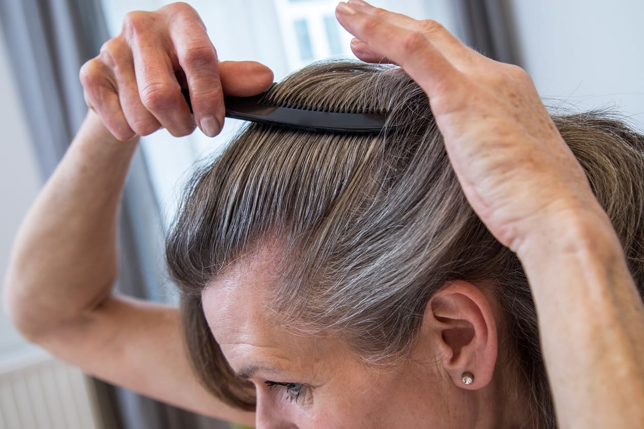 Graue Haare: Eigentlich gibt es sie gar nicht. Das, was grau aussieht, sind farblose Haare. Sie wirken nur im Kontrast zu den übrigen Haaren grau.