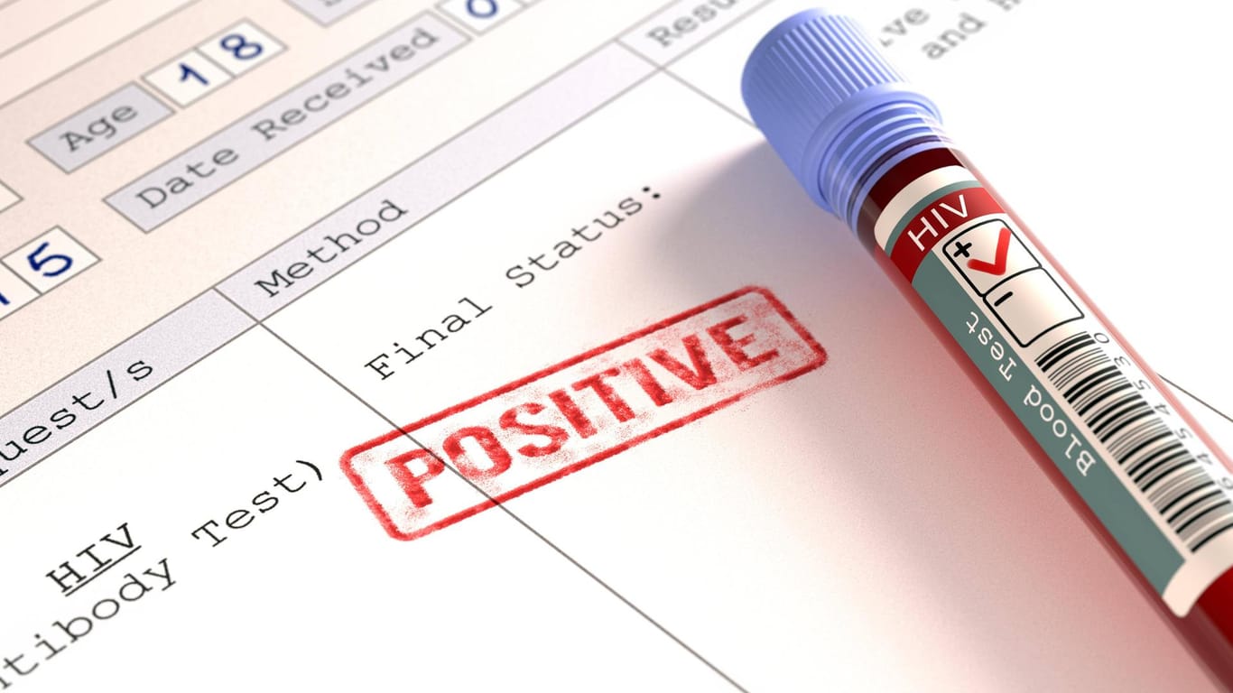 Positiver HIV-Test (Symbolbild): Eine Argentinierin hat das Virus besiegt, ganz ohne Arzneimittel.