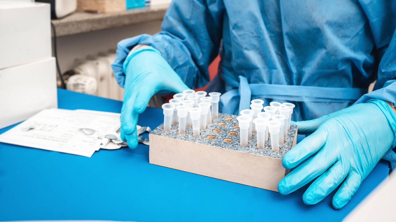 In einem Labor werden Corona-Tests vorbereitet (Symbolbild): In Deutschland werden Höchstwerte bei Infektionen erreicht.