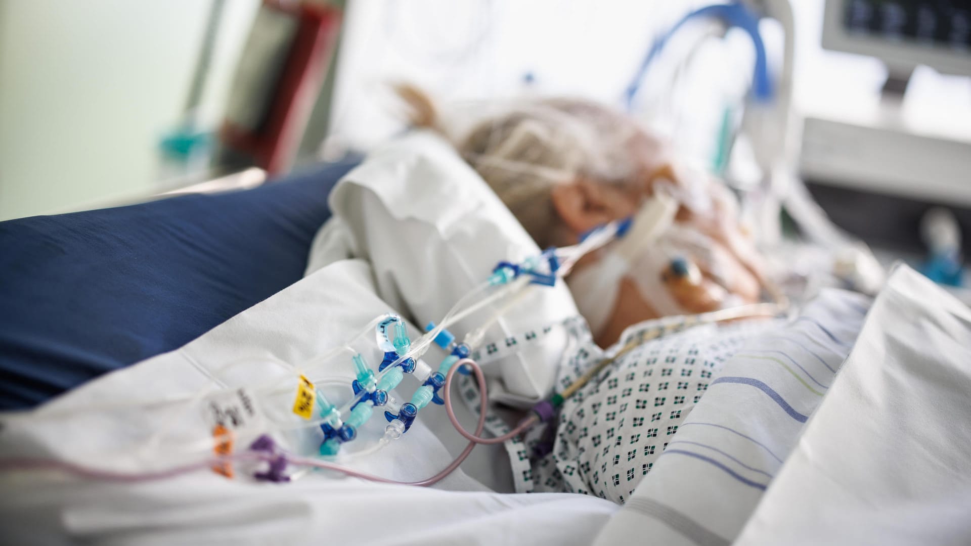 Infusionsschläuche sind am Bett eines intubierten Corona-Patienten in einem Intensivbett-Zimmer (Archivbild): Personalmangel gefährdet massiv die Patientenversorgung in Kliniken.