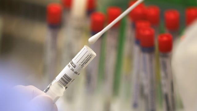 Ein Abstrich wird in einem Labor auf das Coronavirus untersucht (Symbolbild): Bei steigenden Corona-Zahlen könnten die Regeln weiter verschärft werden. Ein Abstrich wird in einem Labor auf das Coronavirus untersucht (Symbolbild): Bei steigenden Corona-Zahlen könnten die Regeln weiter verschärft werden.