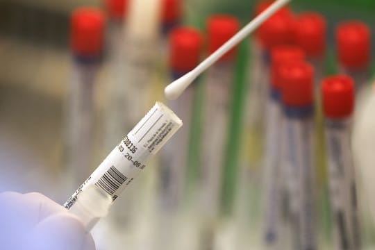 Ein Abstrich wird in einem Labor auf das Coronavirus untersucht (Symbolbild): Bei steigenden Corona-Zahlen könnten die Regeln weiter verschärft werden.