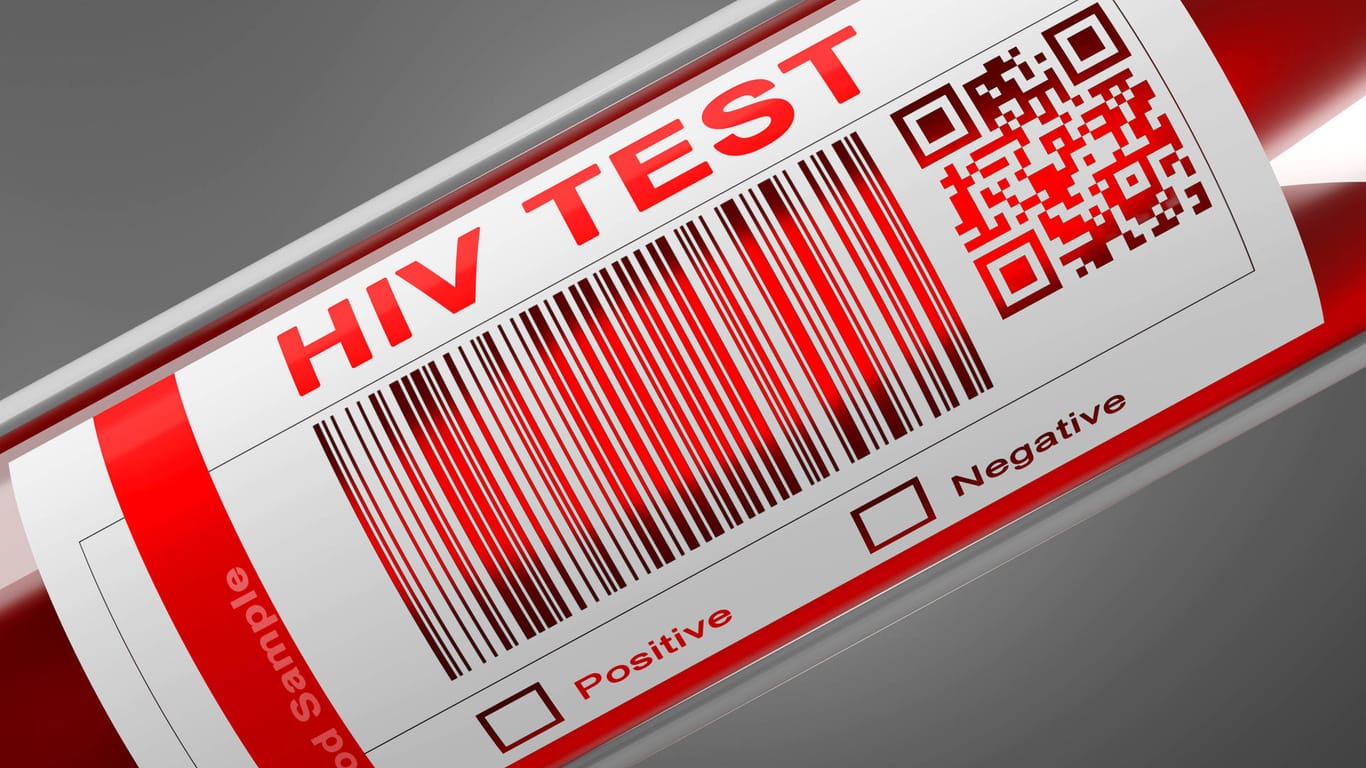 Sinkende HIV-Neuinfektionen: Das RKI vermutet weniger sexuelle Kontakte wegen der Pandemie.