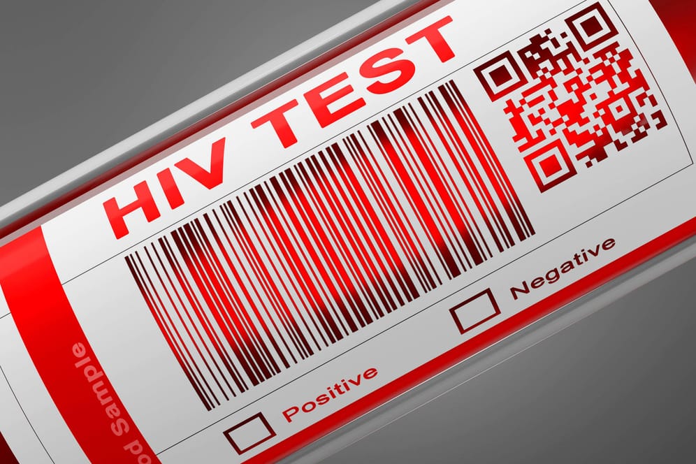 Sinkende HIV-Neuinfektionen: Das RKI vermutet weniger sexuelle Kontakte wegen der Pandemie.