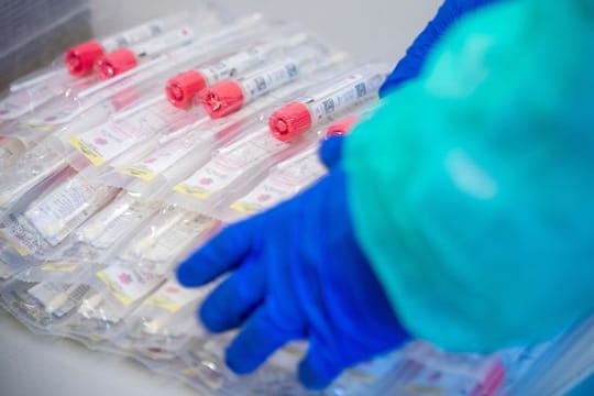 Testsets mit Abstrichstäbchen liegen in einem Testzentrum für Corona-Verdachtsfälle (Symbolbild): Etwa 70 Teststellen gibt es in Hannover.