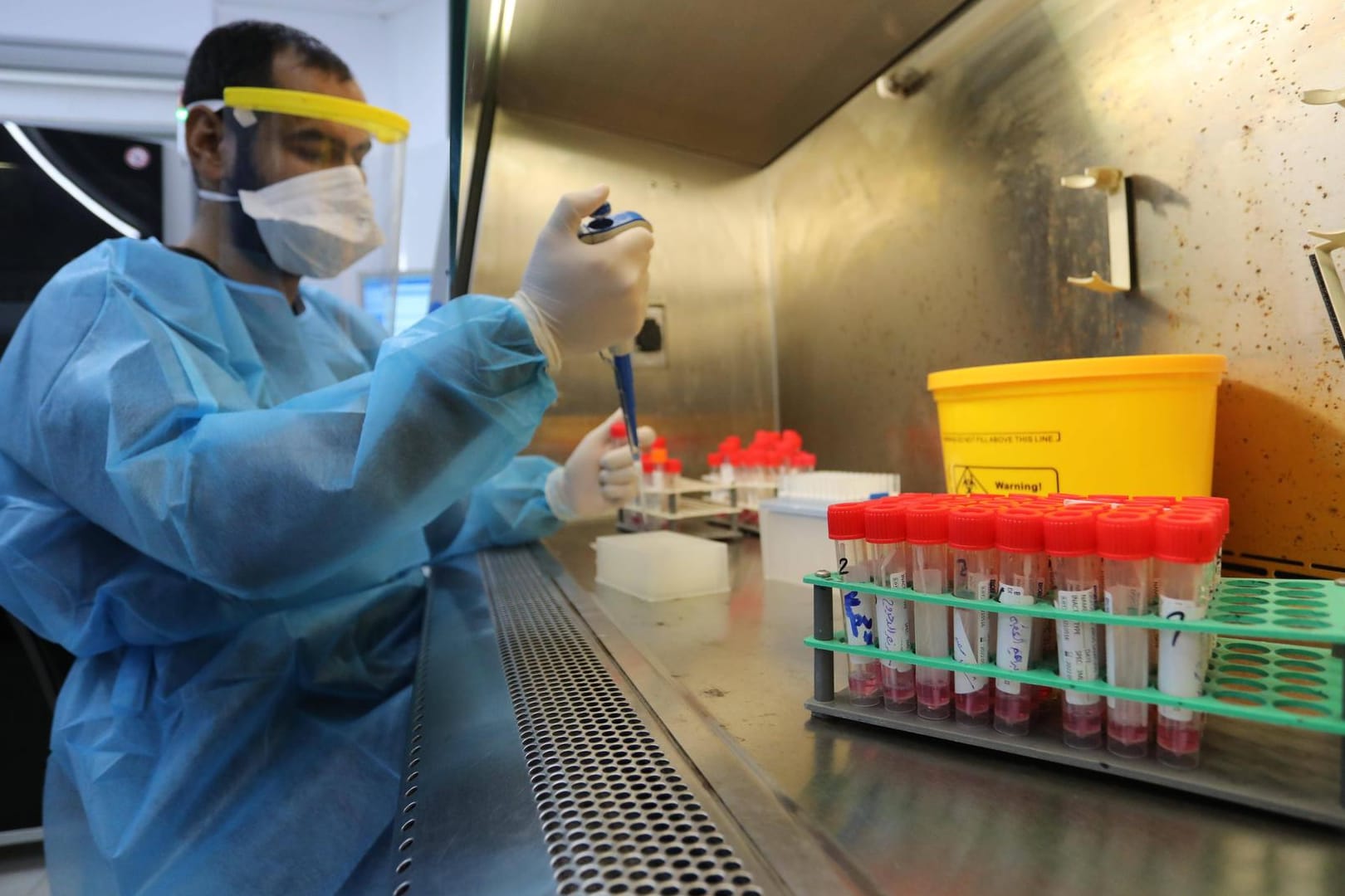 Forscher untersucht Coronaviren (Symbolbild): Die Weltgesundheitsorganisation (WHO) stufte Omikron bereits als "besorgniserregend" ein.