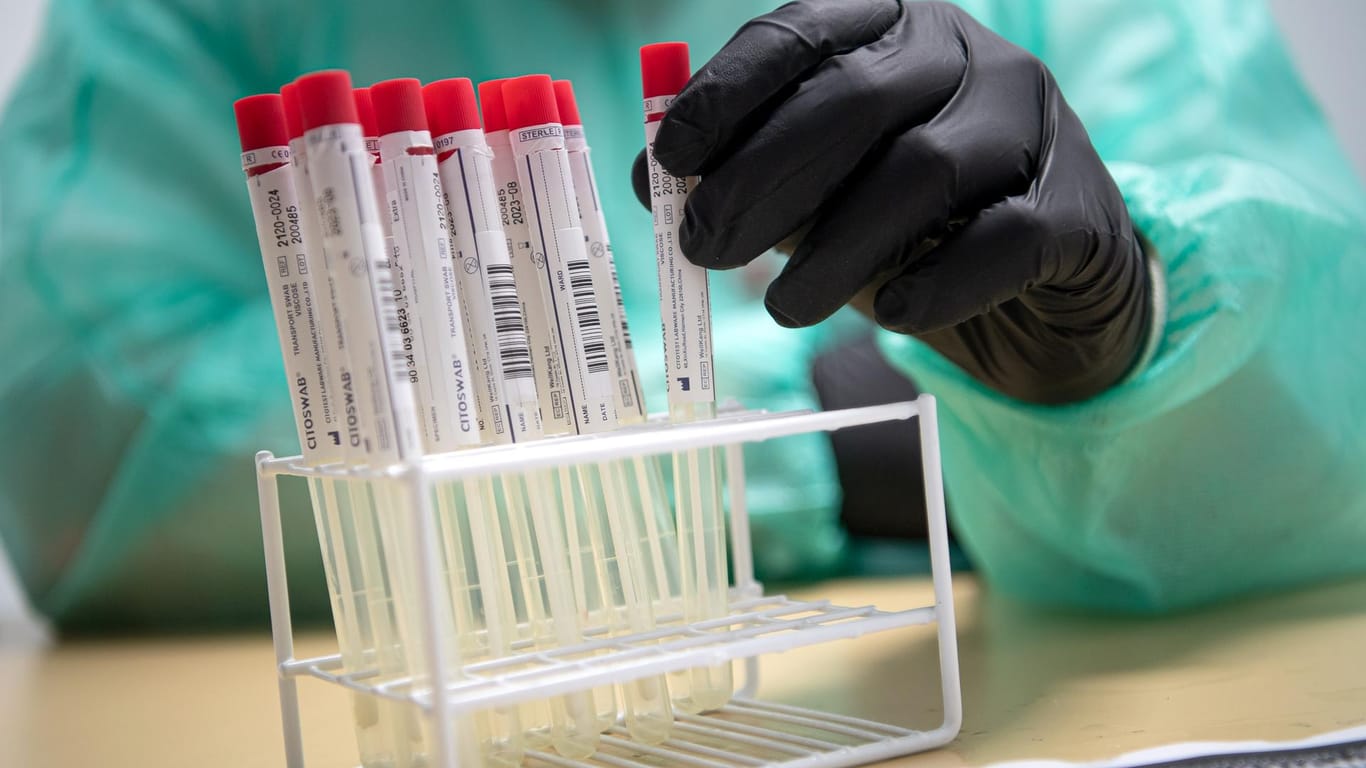 Proben für einen PCR-Test: Die Omikron-Variante, von der bereits einige Fälle in Europa nachgewiesen wurden, bereitet vielen Menschen Sorgen.