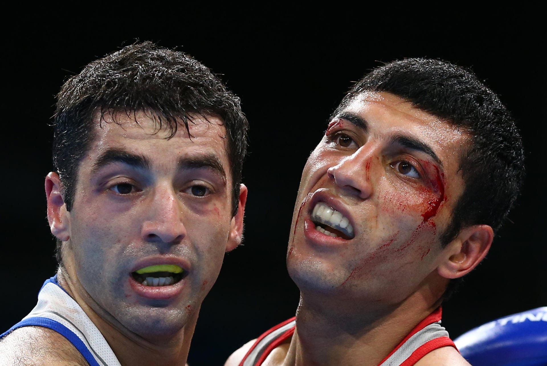 Blutig geht es im Box-Finale zwischen Shakhobidin Zoirov aus Usbekistan und dem Russen Misha Aloian zu.