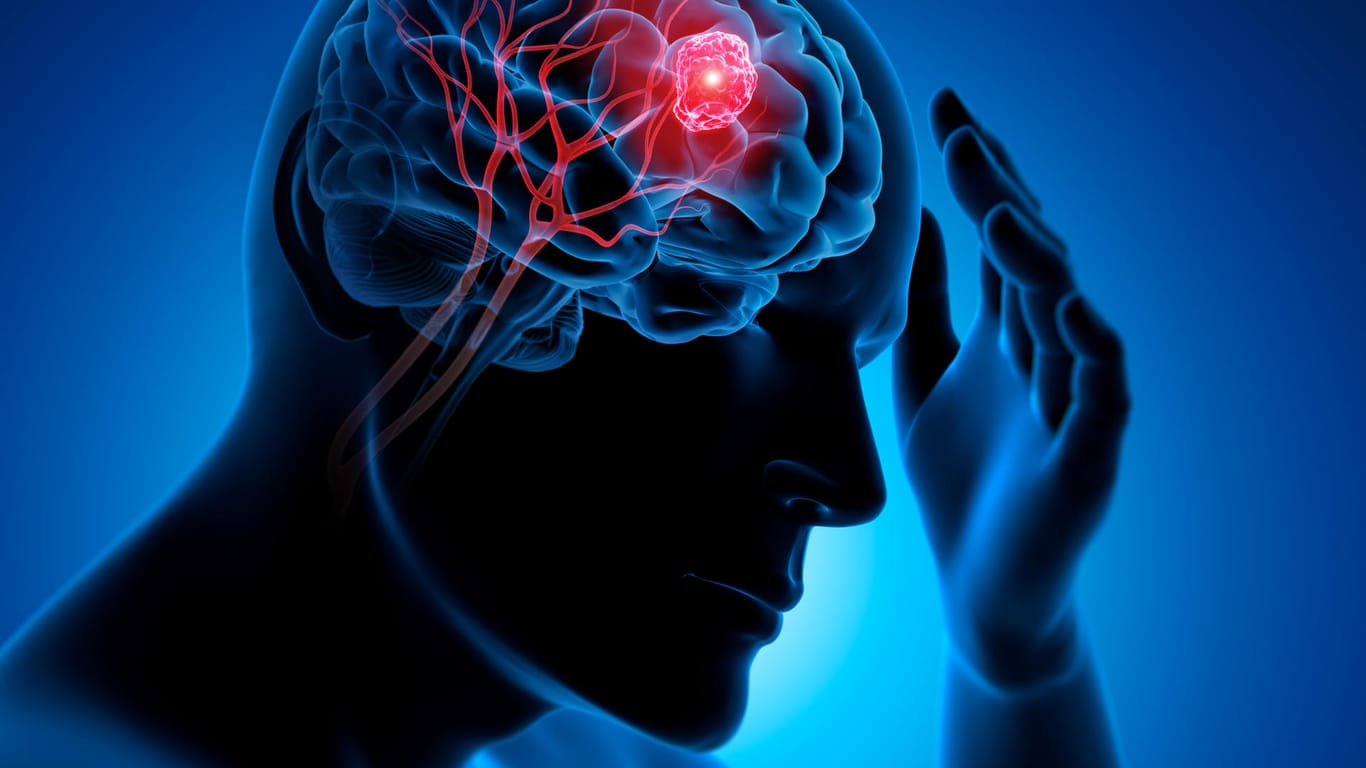 Grafische 3-D-Illustration des Gehirns: Je früher ein Hirntumor entdeckt wird, desto höher sind seine Heilungschancen.