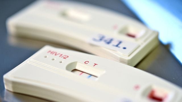 Ein HIV-Schnelltest ist 12 Wochen nach dem Sex verlässlich.