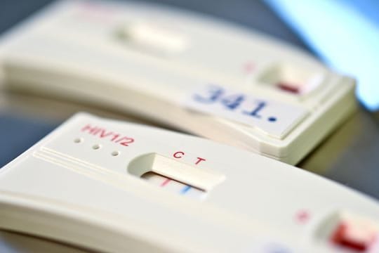 Ein HIV-Schnelltest ist 12 Wochen nach dem Sex verlässlich.