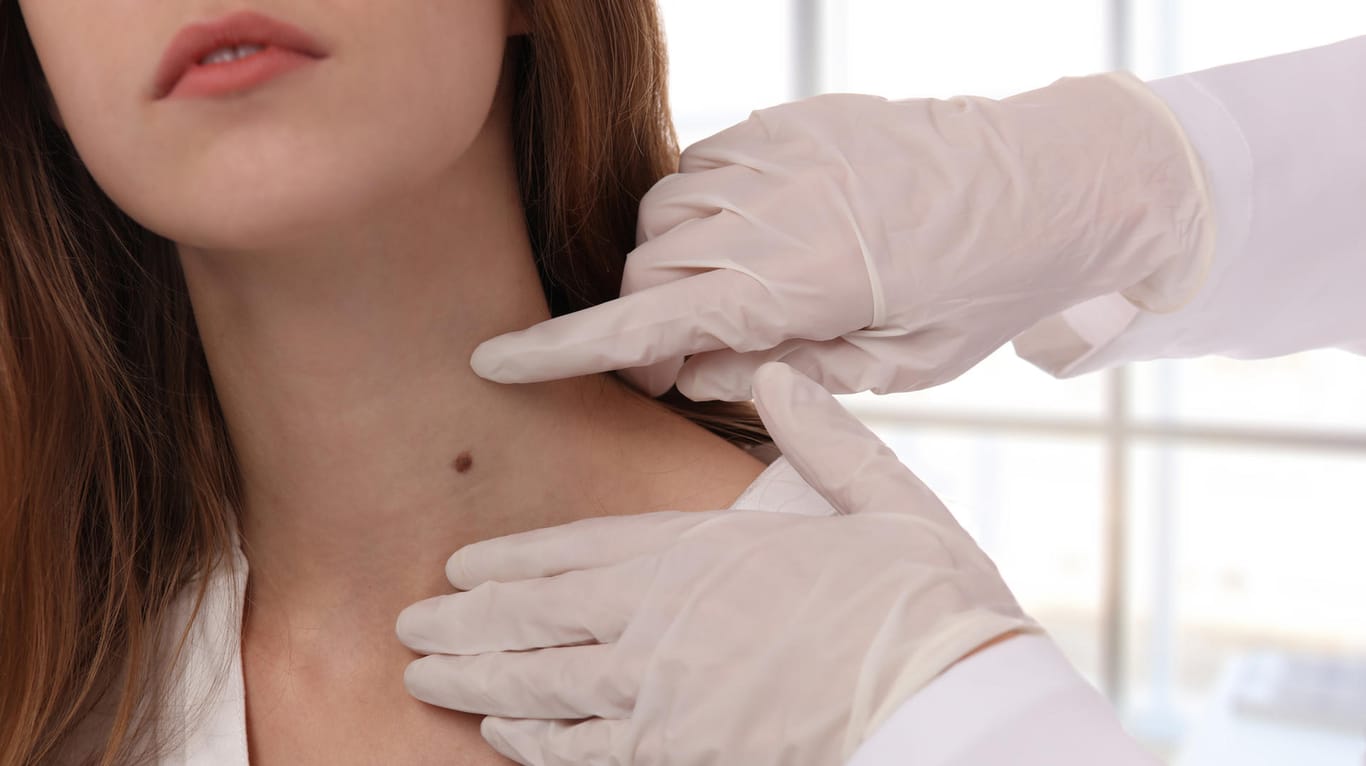Hautkrebs tritt häufig im Halsbereich auf. Wird er frühzeitig erkannt, lässt er sich dank neuer Verfahren oft gut behandeln.