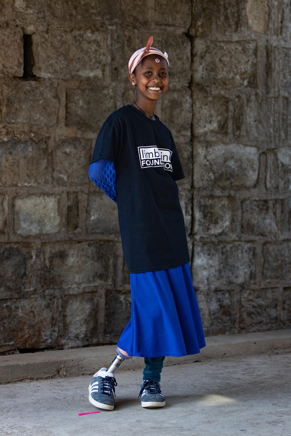 Matilde Simas aus den USA fotografierte ein Mädchen mit einer Beinprothese. Cure, eine christliche Non-Profit-Organisation aus Kanada, unterstützt Kinder, die aus verschiedenen Gründen keine Beine mehr haben, mit Prothesen. Das Foto zeigt die Freude eines Mädchens mit ihrer neuen Prothese.