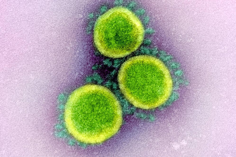 Novel Coronavirus SARS-CoV-2, the virus that causes COVID19. Three virus particles (turquoise) isolated from a patient.