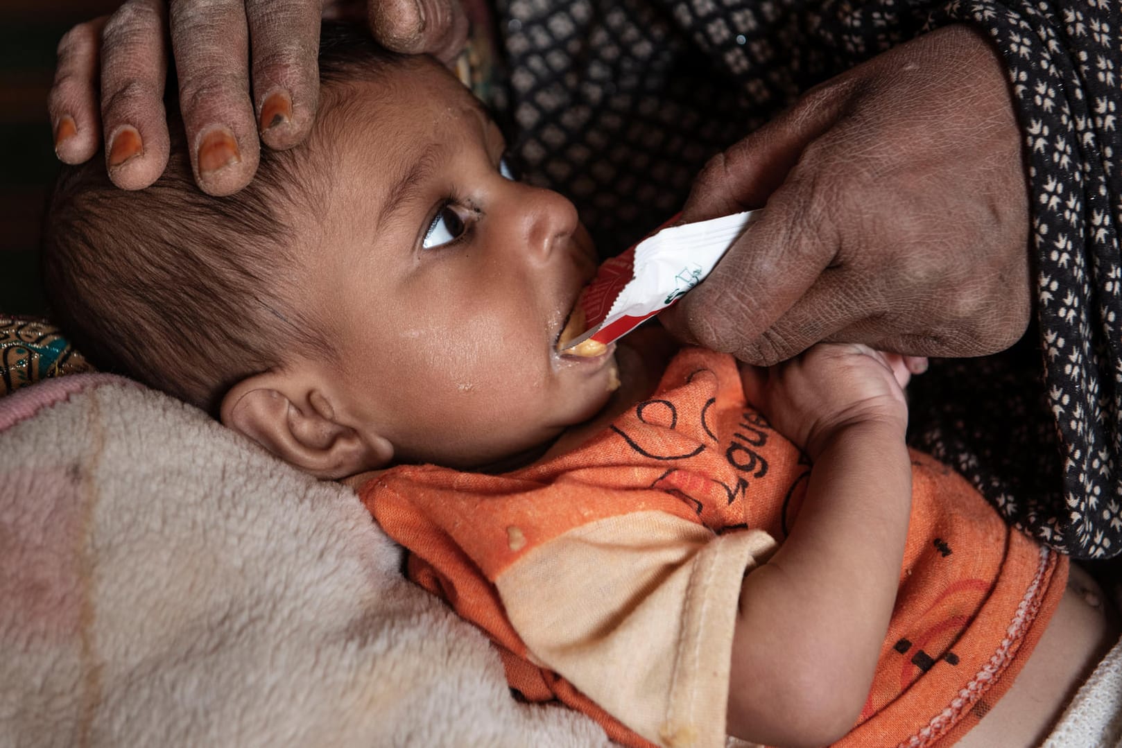 Der neun Monate alte Mansor Ahmad liegt auf dem Schoß seiner Großmutter und wird gefüttert: Millionen Kinder in Afghanistan sind schwer unterernährt und kämpfen um ihr Leben.