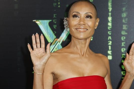 Die US-Schauspielerin Jada Pinkett Smith leidet unter Haarausfall.