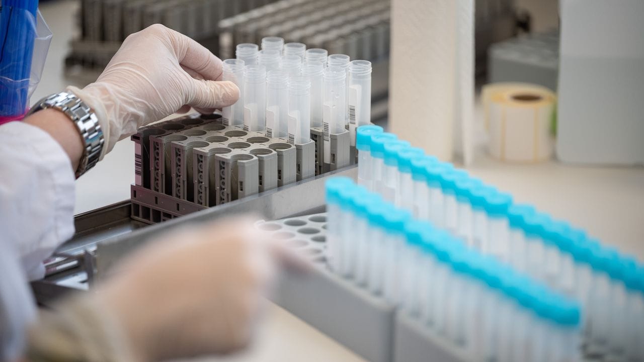Der Omikron-Anstieg weist relativ sicher darauf hin, dass die neue Variante einen immer größeren Anteil am Infektionsgeschehen hat. Der Omikron-Anstieg weist relativ sicher darauf hin, dass die neue Variante einen immer größeren Anteil am Infektionsgeschehen hat.