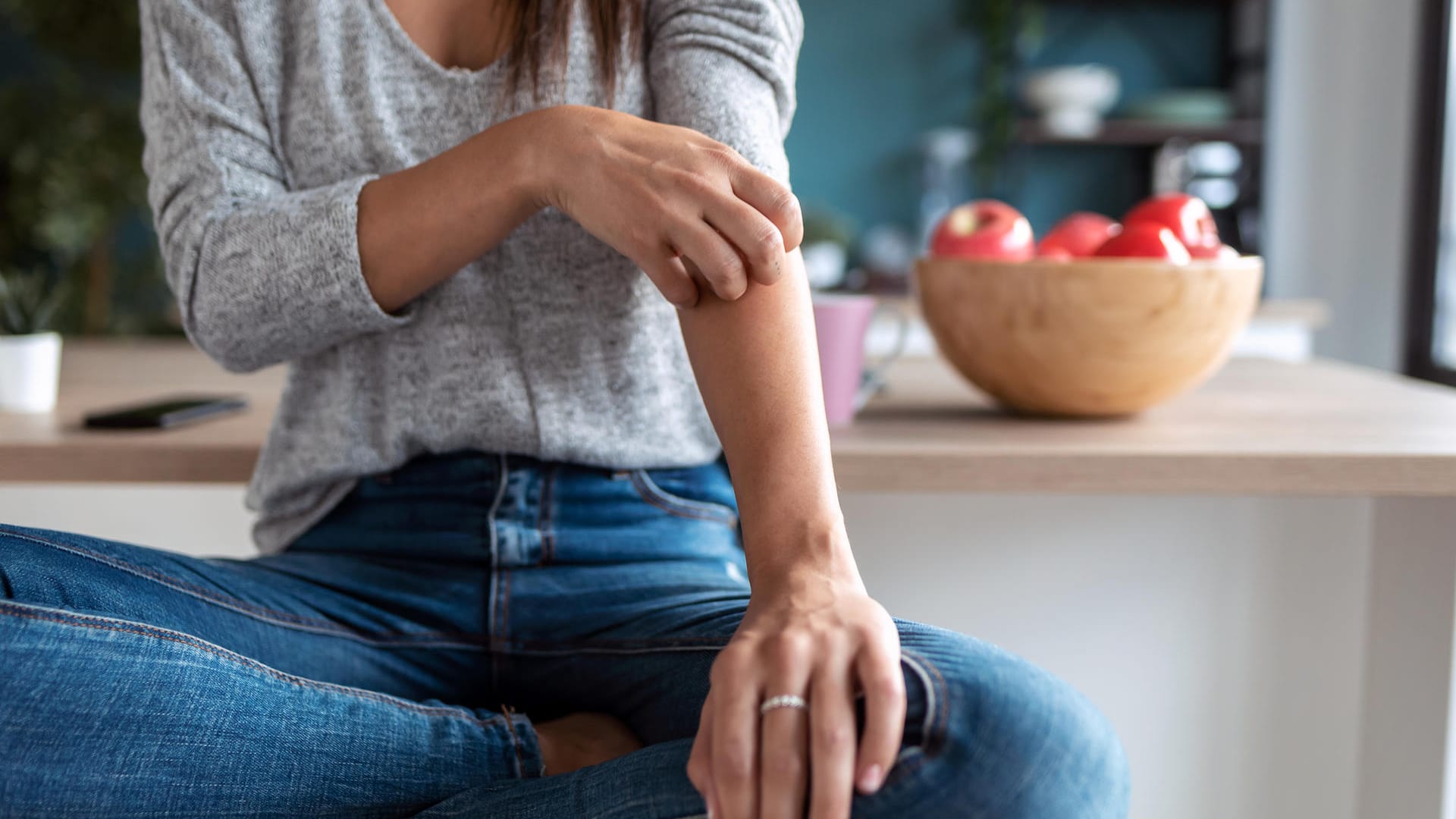 Kratzen ist oft kaum zu vermeiden: Bei Neurodermitis kann der Juckreiz quälend sein.