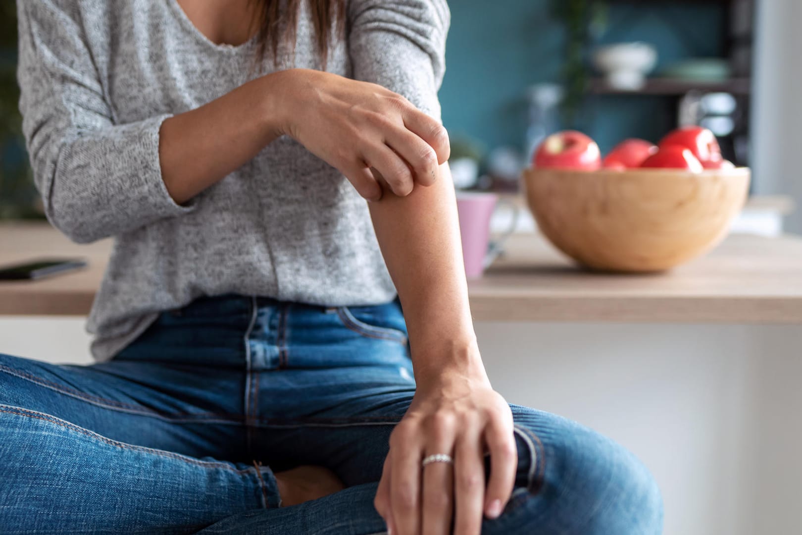 Kratzen ist oft kaum zu vermeiden: Bei Neurodermitis kann der Juckreiz quälend sein.