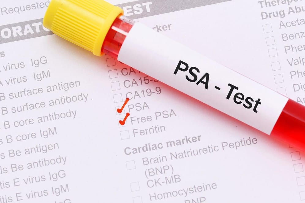 PSA-Test: Er soll helfen, Prostatakrebs zu entdecken, bevor er Beschwerden verursacht. Doch das Verfahren hat Vor- und Nachteile.