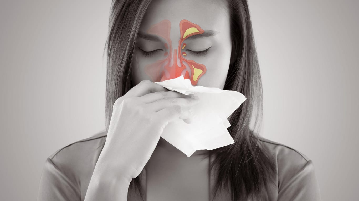 Schnupfen: Eine Hausstauballergie kann sich über die Nase bis zur Lunge ausbreiten und sich zu chronischem Asthma entwickeln.