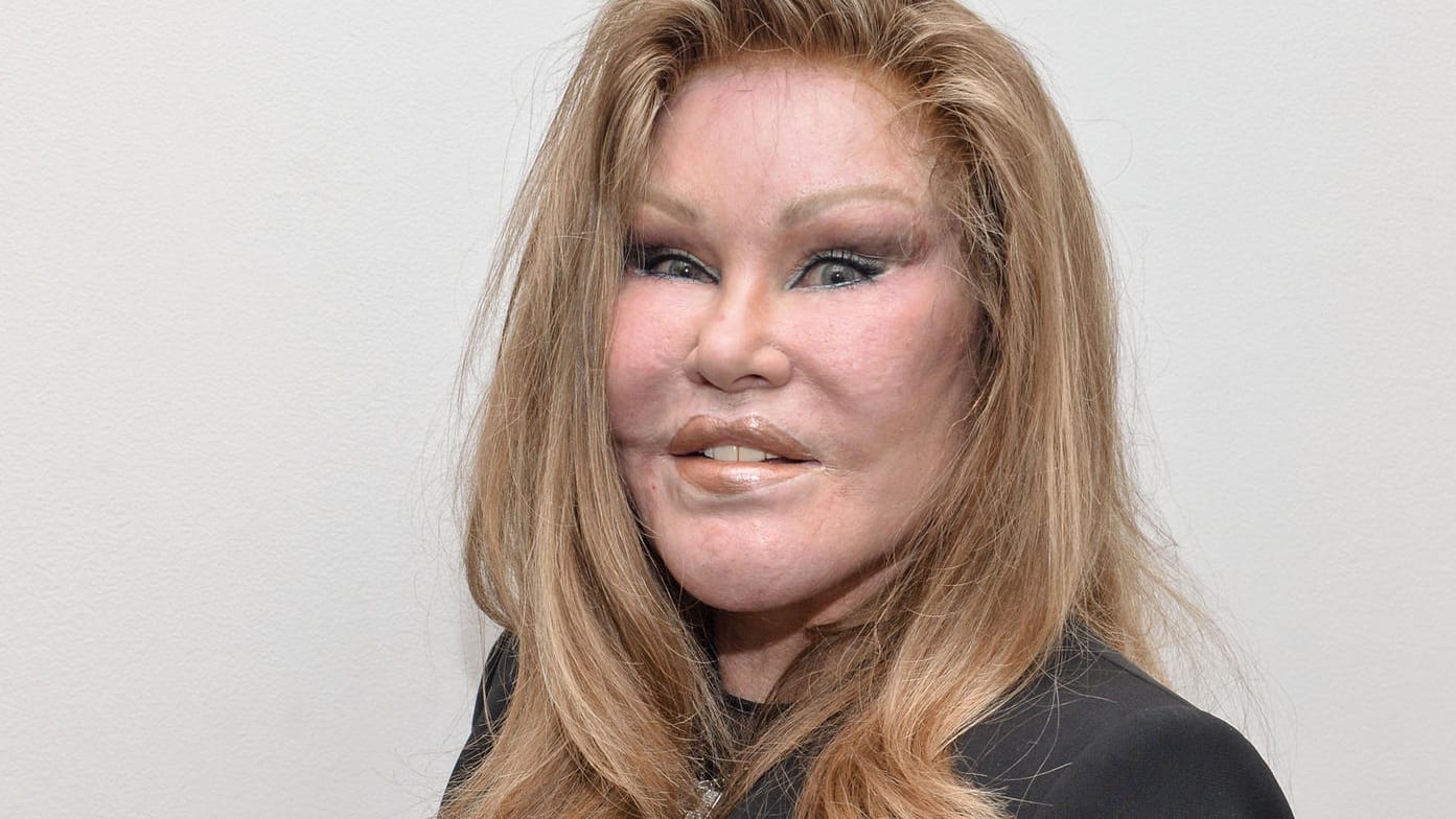 Jocelyn Wildenstein: Die US-amerikanische Societydame hat nach eigenen Angaben mehr als vier Millionen Dollar für OPs ausgegeben.