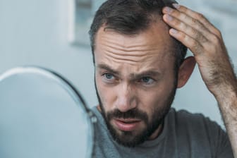 Mann im mittleren Alter mit Haarausfall sieht sich im Spiegel an: Bei etwa 80 Prozent der Männer ist ein Haarausfall genetisch bedingt. Ursache dafür ist eine Überempfindlichkeit der Haarfollikel gegenüber dem männlichen Geschlechtshormon Dihydrotestosteron (DHT). Bei dieser Veranlagung schrumpfen und verkrümmen die Blutgefäße, die die Haarwurzeln mit Nährstoffen versorgen. Unter anderem wird ihre Wachstumsphase beeinträchtigt, so dass die Haare kürzer und weniger nachwachsen.