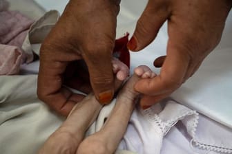 Unternährtes Kind: Die Zahl der an Hunger leidenden Minderjährigen in Afghanistan ist massiv gestiegen.