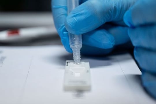 Für Kinder in Schulen und Kitas soll die Quarantäne als Kontaktperson fünf Tage dauern, mit abschließendem PCR- oder Schnelltest.