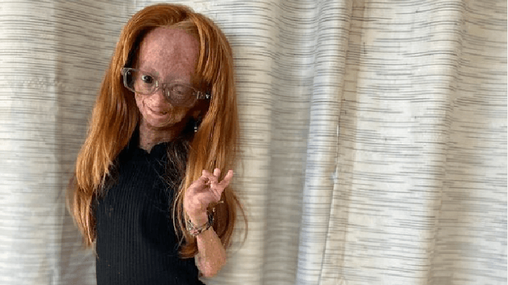 YouTuberin Adalia Rose: Die 15-Jährige ist tot.