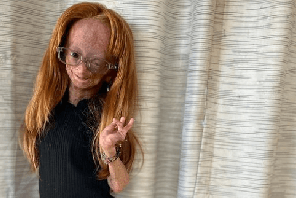 YouTuberin Adalia Rose: Die 15-Jährige ist tot.