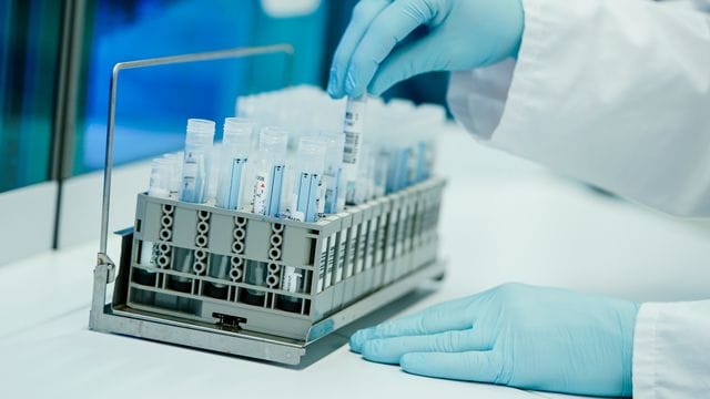 Coronatest-Labor in Heidelberg.