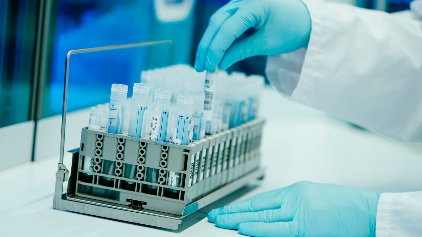 Ein Mitarbeiter hält in einem Coronatest-Labor PCR-Teströhrchen in den Händen (Symbolbild): Um die PCR-Testkapazitäten in Berlin auszubauen, wird vor allem mehr Personal benötigt.