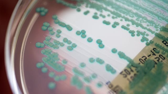 MRSA-Keime (Methicillin-resistente Staphylococcus aureus) zählen zu den Erregern, die 2019 die meisten Todesfälle nach sich zogen.