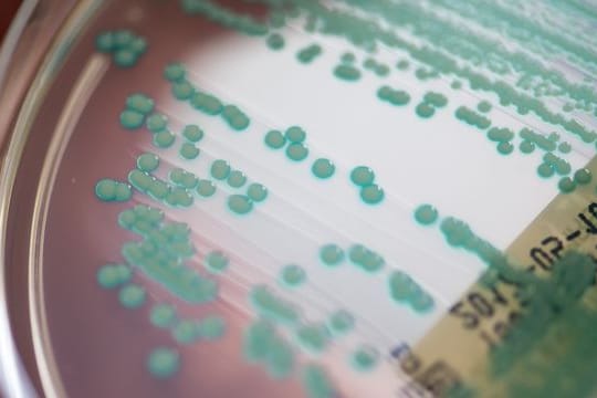 MRSA-Keime (Methicillin-resistente Staphylococcus aureus) zählen zu den Erregern, die 2019 die meisten Todesfälle nach sich zogen.